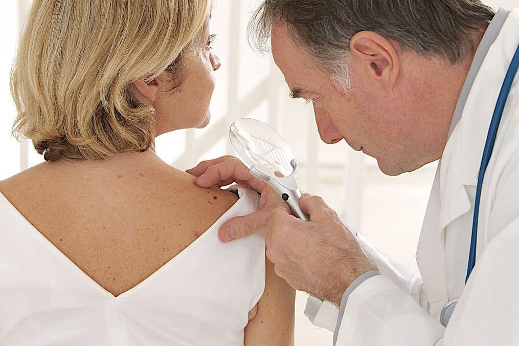 žmogaus papilomos viruso diagnozė